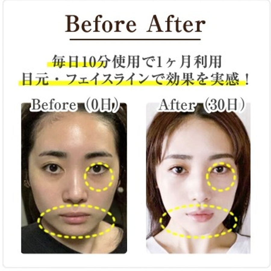 公式】ELFACE A（エルフェイスエー）韓国美顔器[品番