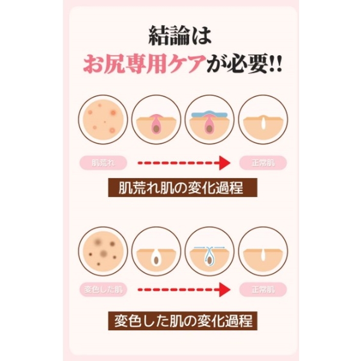 BnD ヒップ・背中鎮静クリーム100gボディークリーム韓国コスメ 韓国 | BnD | 詳細画像5 