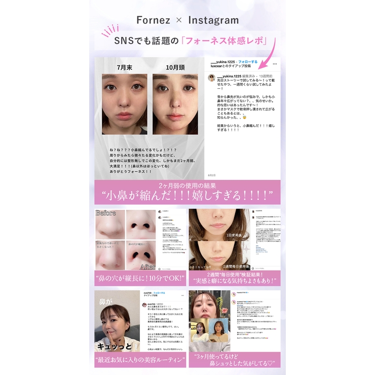 LUXCEAR Fornez | cony | 詳細画像9 