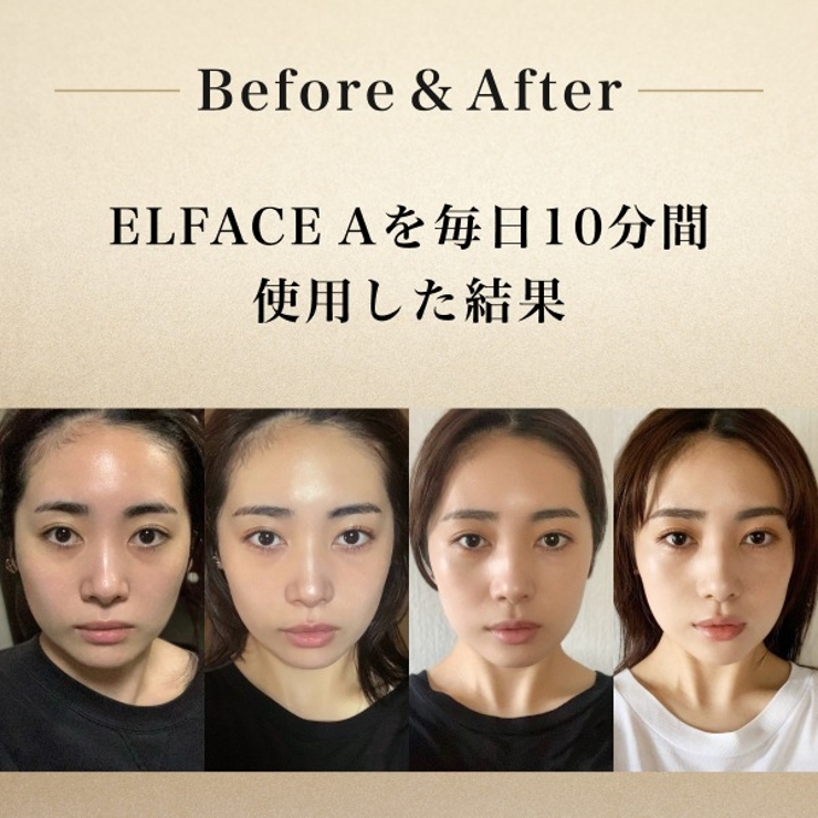 【公式】ELFACE A（エルフェイスエー）韓国美顔器 | K Village | 詳細画像7 
