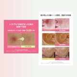 【BeginS ビギンス】【1+1】ピンクグァバグルタチオン痕跡セラム  | COSME Re:MAKE | 詳細画像10 