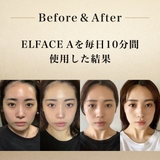 【公式】ELFACE A（エルフェイスエー）韓国美顔器 | K Village | 詳細画像7 