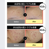 Celladix（セラディックス）トリプルレチノールアンプル 30ml | SYPRÉ | 詳細画像9 