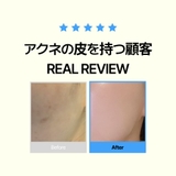 【ニキビケアセット】ニキビ皮脂調節アンプル75ml+クリーム50ml 韓国コスメ… | VICLE | 詳細画像5 